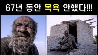 [해외토픽] 세계에서 가장 '더러운' 남자로 알려졌던 노인∥67年風呂入らず「世界一汚い人間」