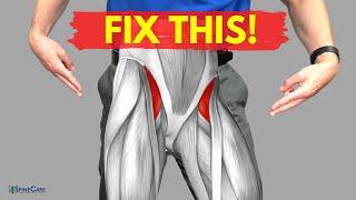 How to Relieve Hip Flexor Pain in 30 SECONDS