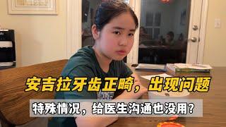 安琪拉矯正牙齒出現意外，美國醫師這處理方式太無語，不能變通？