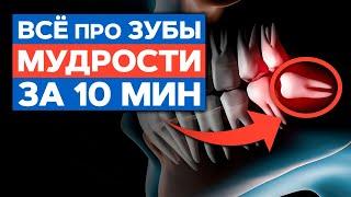 Когда нужно удалять зубы мудрости? / Показания и последствия удаления зубов