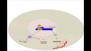 Overcoming hypoxia-mediated chemoresistance - video abstract [58285]