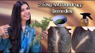 2 Easy Anti Dandruff Remedies / Guaranteed Results - Ghazal Siddique