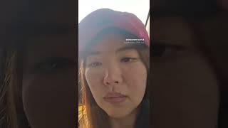 [얼굴기획] 코성형 구축.. 코수술 위험성