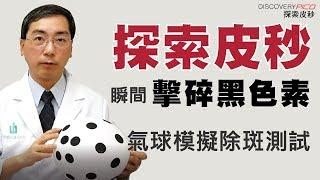 探索皮秒瞬間擊碎黑色素 林政賢醫師氣球模擬除斑測試 【DiscoveryPICO 探索皮秒】林政賢皮膚科診所