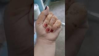 4 fingers?????????#shorts #shortvideos #trending