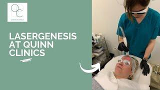 Laser Genesis Skin Treatment Demo - at Quinn Clinics MediSpa, Bristol