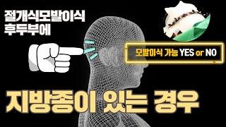 모발이식 뒷머리 후두부 지방종이 있는 경우 절개 모발이식 가능한지 루트에 물어 보았습니다.