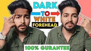 Dark Forehead to White Forehead 100% Gurantee | Sahil Nagpal