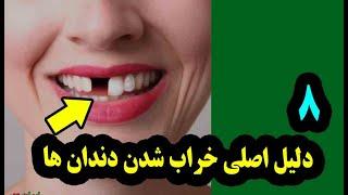 ۸ دلیل اصلی خراب شدن دندان ها