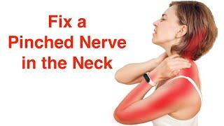 Fix a Pinched Nerve in the Neck (With FREE Exercise Sheet!)