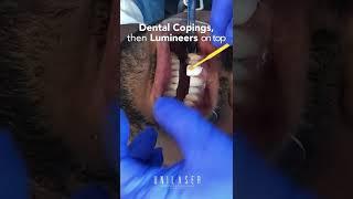 Behind an Unilaser smile | oral rehabilitation