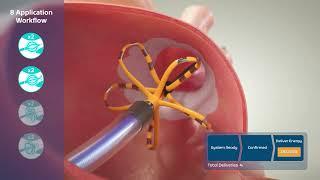 FARAPULSE™ Pulsed Field Ablation System Animation