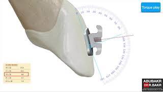 I) why we need to control the torque during labial segment retraction?