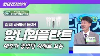 실제 사례로 알아보는 앞니임플란트이야기! #디지털임플란트