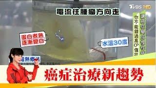 癌症治療新趨勢！搭配「電熱療法」熱死癌細胞 健康2.0