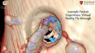 Stanford Neurosurgery Virtual Reality Lab's Anatomy in 3D: DBS STN target