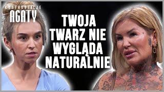 POWIEDZIAŁA JEJ TO PROSTO W TWARZ  "TWOJE ZABIEGI NISZCZĄ MIĘŚNIE. SĄ  ZŁE" | Konfrontacje Agaty