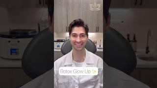 Botox Glow Up 