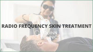 Candela Etwo SUBLATIVE RADIO FREQUENCY SKIN TREATMENT at Quinn Clinics Bristol