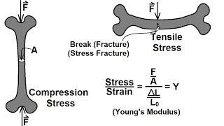 Physics - Mechanics: Stress and Strain (4 of 16) Bone Strength