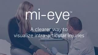 mi-eye: An Alternative to the MRI