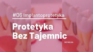 Protetyka bez tajemnic #06 - Implantoprotetyka