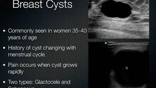 Breast Ultrasound