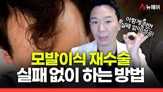 모발이식 재수술! 실패 없이 하는 방법 총정리ㅣ뉴헤어