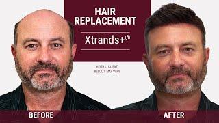 Striking hair transformations [Hair Replacement Solutions by HairClub]