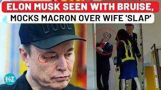 Macron Wife Slap: Trump, Elon Musk Make Fun Of France Leader After Tesla CEO Seen With Bruised Eye