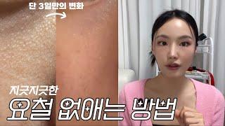 ENG CC) NOT SPONSORED How to get rid of bumpy skin *real before & after/product recs* 