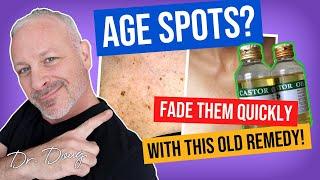 AGE SPOTS?   Natural Remedy with CASTOR OIL!  |  Dr. Doug Willen