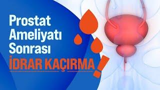 Prostat Ameliyatı Nasıl Yapılır? Prostat Ameliyatı Sonrası İdrar Kaçırma