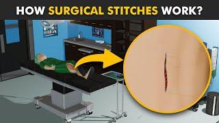 How Stitches Work In Body? (3D Animation) | Healing Process Of Surgical Wounds