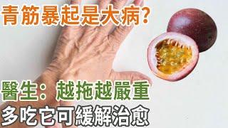 青筋暴起是大病！醫生：越拖越嚴重，多吃它可緩解治愈#養之道#健康#養生#青筋暴起