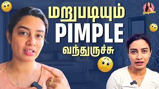 Pimple வந்தா இனி வருத்தப்பட வேண்டாம் | Skin & Hair Care | Sangeetha Says