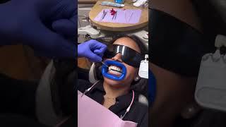 Teeth Whitening at Total Dentistry