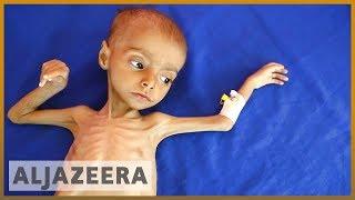  19 million Yemeni children suffer malnutrition and illness l Al Jazeera English