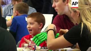 Children given prosthetic hands made on printer