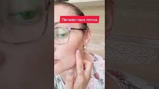 Пигментные пятна больше не проблема! #пятна #пигментныепятна #советы #полезныесоветы #лайфхак