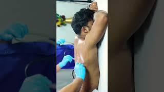 முதுகில் உள்ள கருமை நீக்கும்#backpigmentation#cupping#halinacupping#hijama#cuppingtherapy