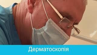 Дерматоскопия - метод проверки новообразований на коже