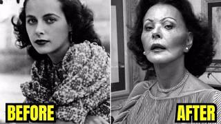 20 RARE Pre-Plastic-Surgeries in Old Hollywood History