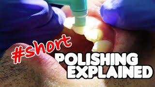 Dental Cleaning | Teeth Polishing Explained #shorts #dentalhygienist #teethcleaning