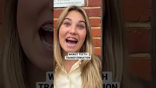 Worst Teeth Transformation #shorts #braces #teeth