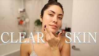 How I Cleared Up a Bad Breakout and Faded Post Acne Marks FAST | Melissa Alatorre