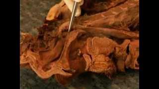 MNF Medad Team | Dr. Ayman Abdallah H&N Practical Anatomy [ Spotting 01 ]
