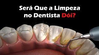 Como é Feita a Limpeza no Dentista - Remoção De Tártaro