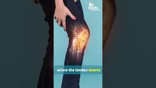 Knee & Ankle Pain in Kids: Apophysitis Explained | Dr. Raviteja Rudraraju | Apollo Hospitals