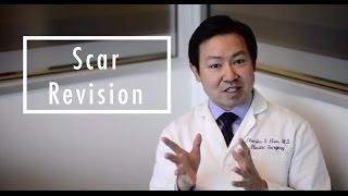 Scar Revision